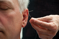 IM_acupuncture10_4587_200 <p>Another service offered by the integrative medicine clinics is acupuncture, which is designed to stimulate the natural healing processes of the body and is used to treat problems such as stress, nausea, pain, and other conditions.</p>