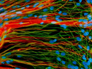 Derived from human embryonic stem cells, precursor neural cells grow in a lab dish and generate mature neurons (red) and glial cells (green)