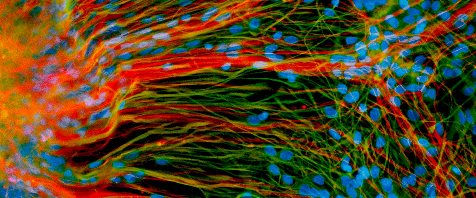 Derived from human embryonic stem cells, precursor neural cells grow in a lab dish and generate mature neurons (red) and glial cells (green)