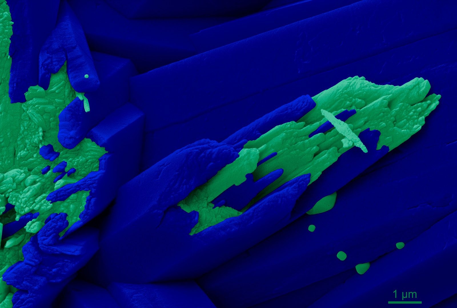Blue and green colored micrograph of coral skeleton