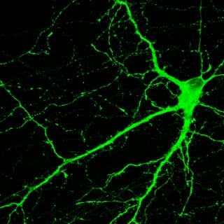 Microscope rendering of neurons.