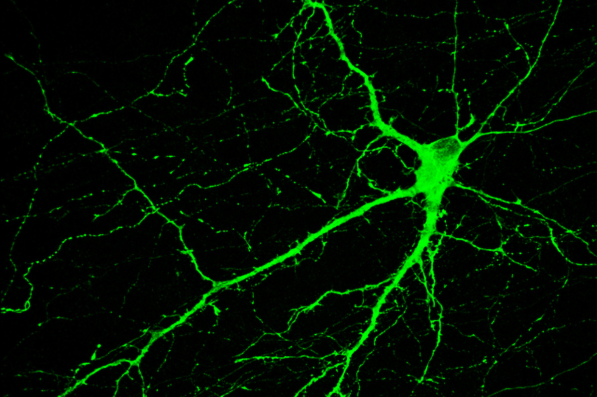 Microscope rendering of neurons.