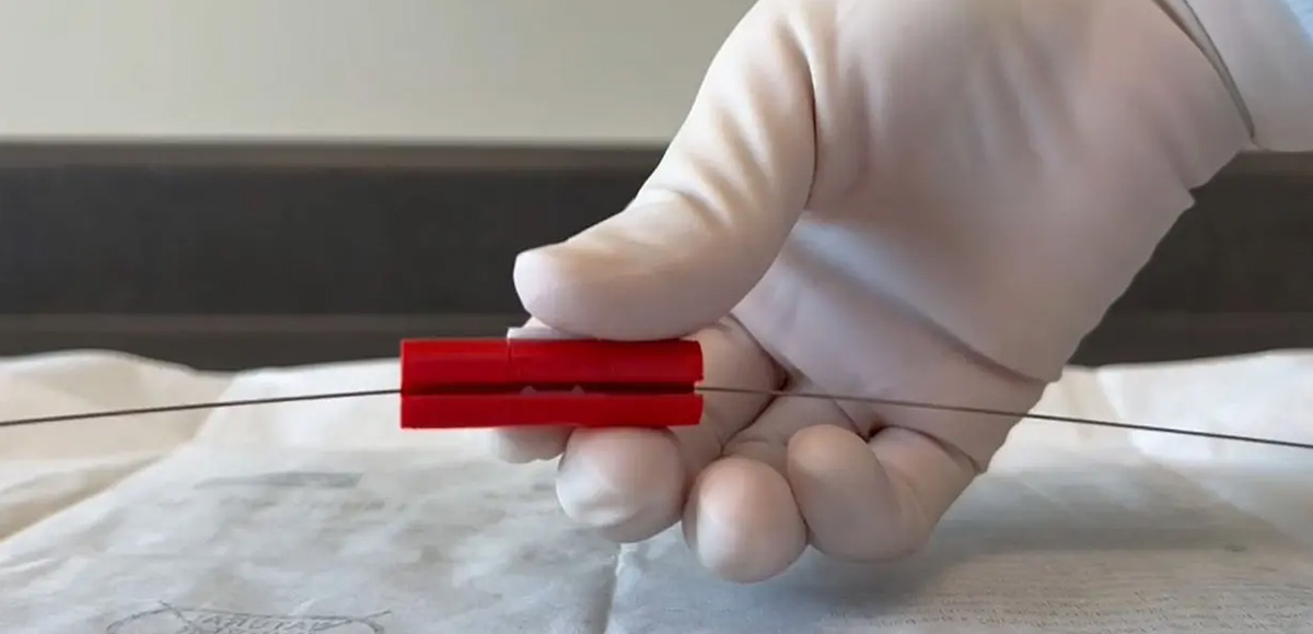 A gloved hand displays a red plastic cylinder clipped onto a guidewire.