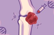 Illustration of a knee joint receiving an injection of red fluid from a syringe, with DNA helix symbols in the background on a purple backdrop.