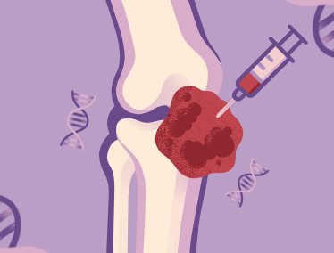 Illustration of a knee joint receiving an injection of red fluid from a syringe, with DNA helix symbols in the background on a purple backdrop.