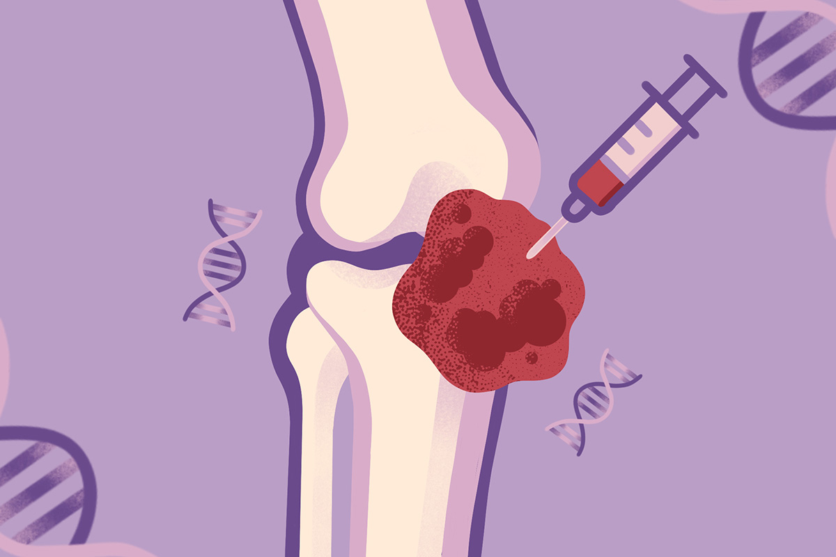 Illustration of a knee joint receiving an injection of red fluid from a syringe, with DNA helix symbols in the background on a purple backdrop.